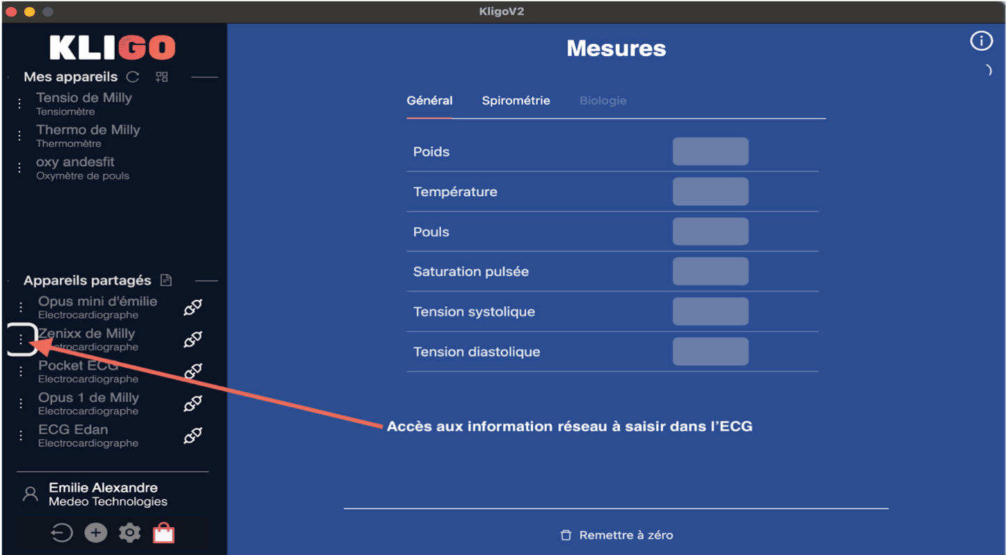 Formulaire de création de compte EtherEgo - Etape 2 : Profession