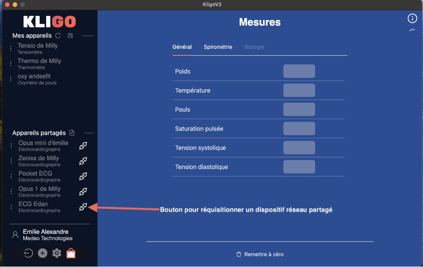 Formulaire de création de compte EtherEgo - Etape 2 : Profession