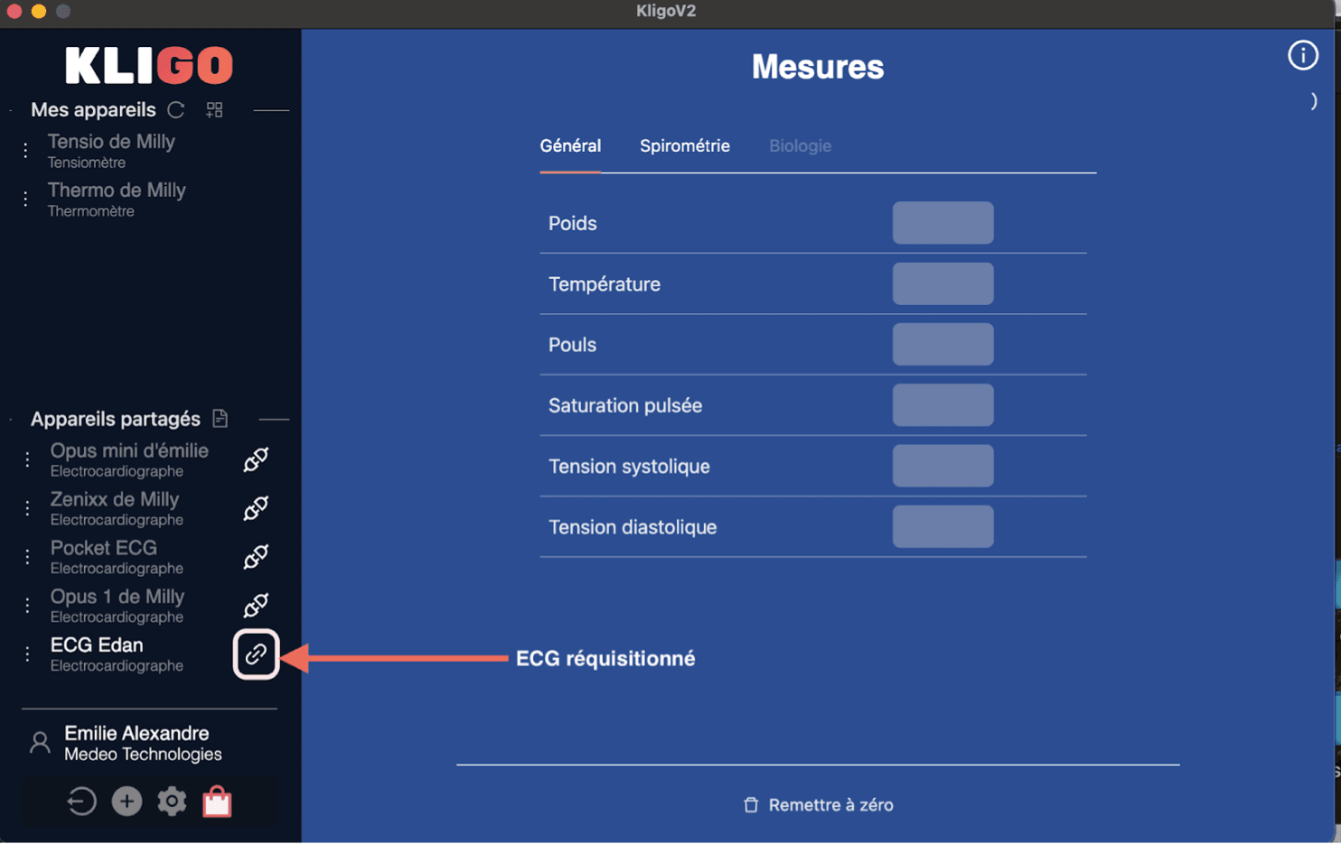 Formulaire de création de compte EtherEgo - Etape 2 : Profession
